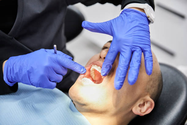 Best Emergency Dental Care for Broken or Chipped Teeth in College Park, GA