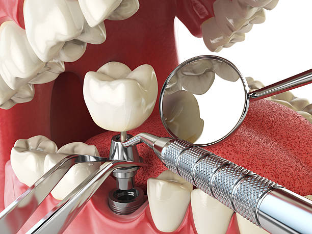 Best Same-Day Emergency Dental Services in College Park, GA